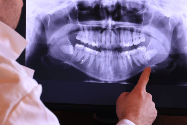 Best Walk-In Emergency Dental Services in Elm Creek, NE